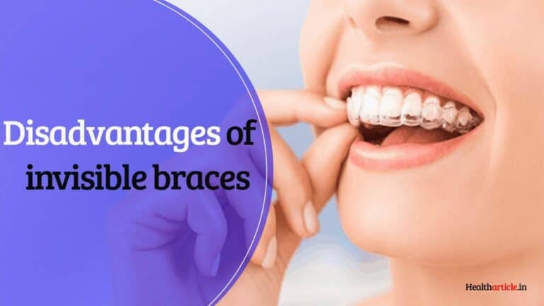 diadvantages of invisible braces